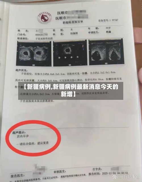 【新疆病例,新疆病例最新消息今天的新增】-第3张图片