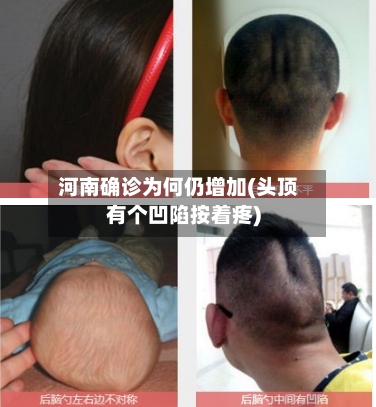 河南确诊为何仍增加(头顶有个凹陷按着疼)